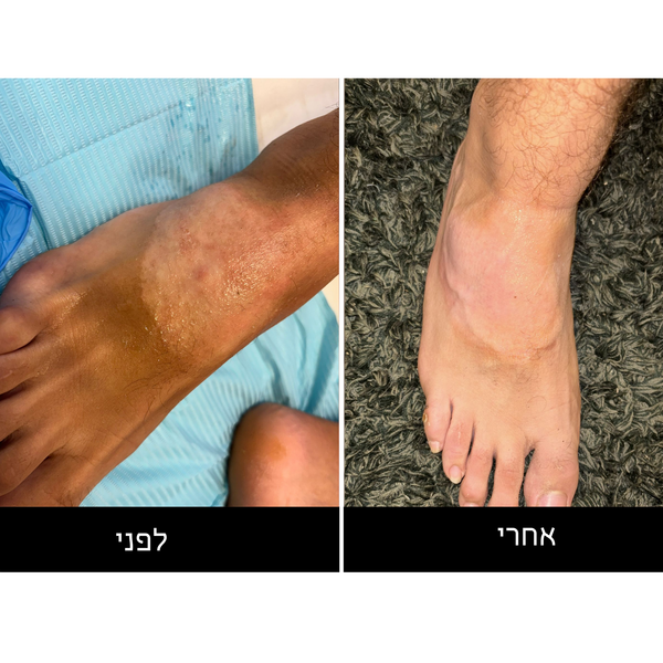 Unfung Skin Solution