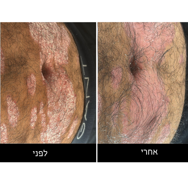 Unfung Skin Solution